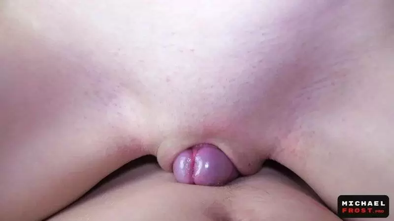 POST THUMB